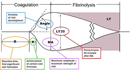 Thromboelastogram