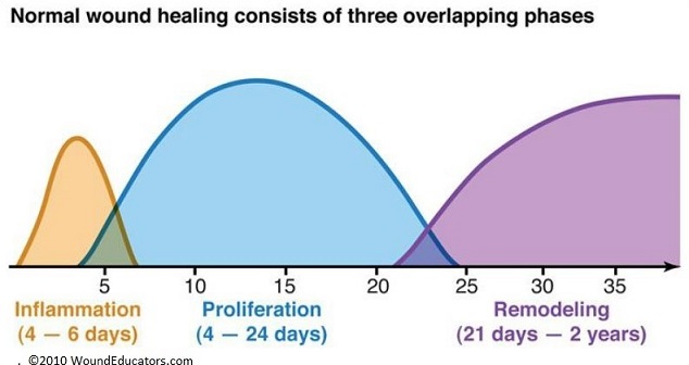 Phases of Wound Healing