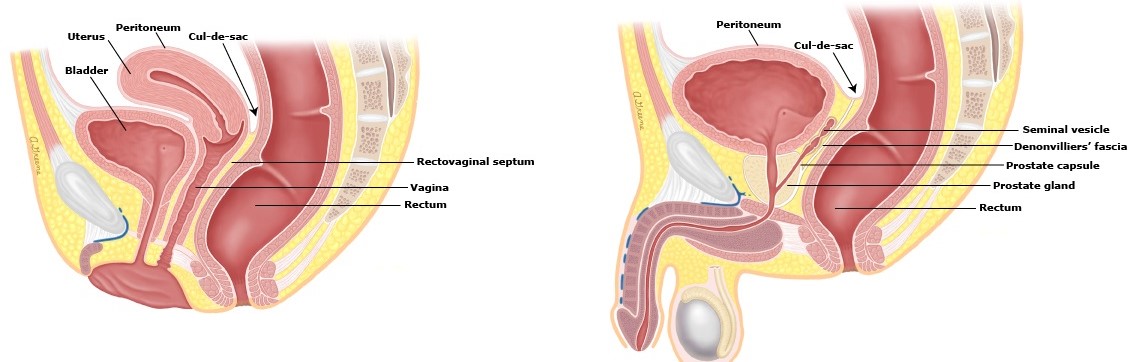 Female and Male Pelvises