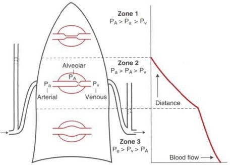 Pulmonary West Zones