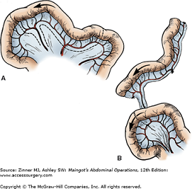 Jejunal Interposition Pedicle Graft