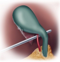 Critical View - Posterior