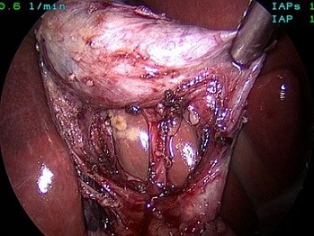 Critical View - Posterior