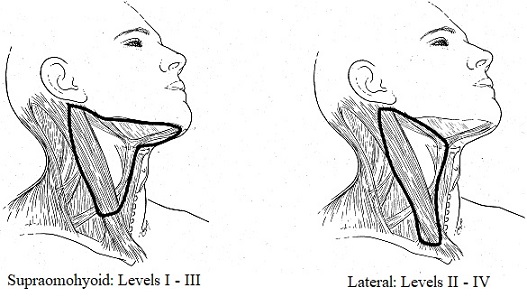 Omohyoid and Lateral Neck Dissections