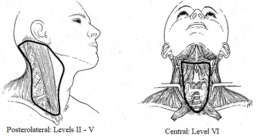 Posterolateral and Central Neck Dissections