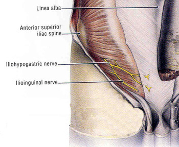 Ilioinguinal and Iliohypogastric Nerves