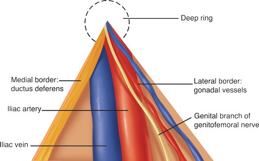 Triangle of Doom