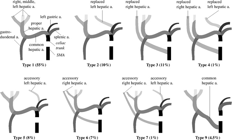 Hepatic Artery Variations