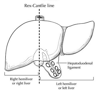 Cantlie's Line