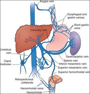 Portosystemic Collaterals