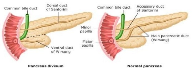 Pancreas Divisum