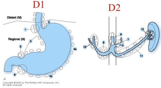 D1 and D2 lymphadenectomies