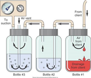 Chest Tube Drainage Mechanics