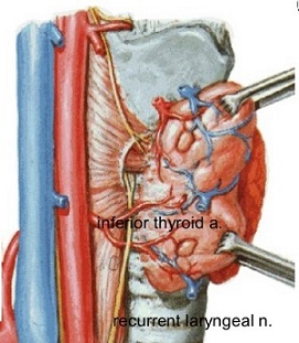 Recurrent Laryngeal Nerve - Lateral