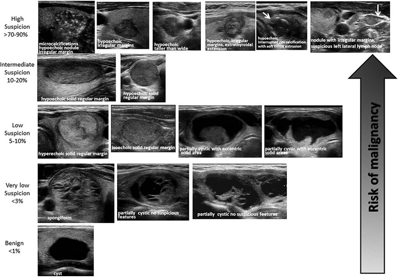 Thyroid Nodule Ultrasound Images