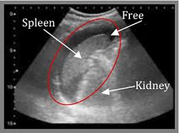 FAST - Positive LUQ Scan