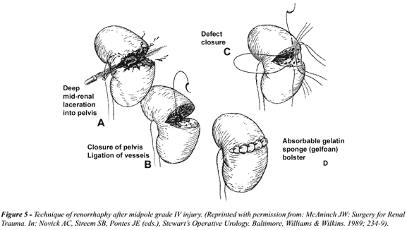 Renorrhaphy