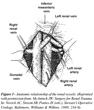 Vascular Exposure of the Kidneys