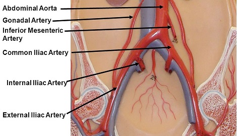 Iliac Vessels