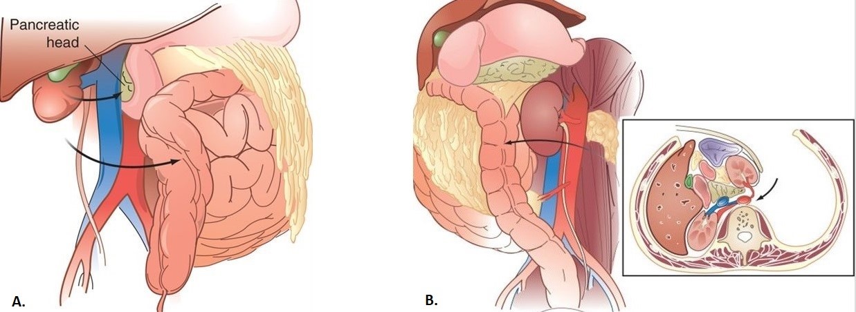 Left and Right Medial Visceral Rotations