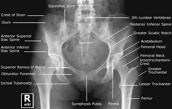 AP Pelvis X-ray