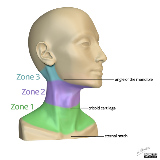 Trauma Neck Zones of Injury