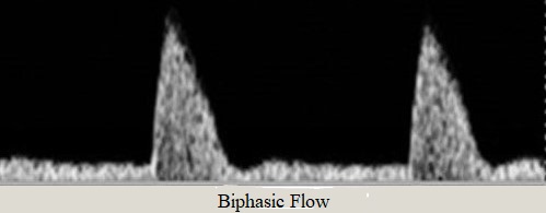 Biphasic Flow