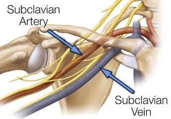 Subclavian Vein Anatomy